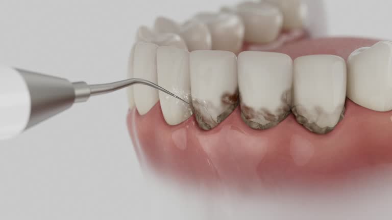 Reliable Dental contractor in Buckhead, GA by Dentist Open Now